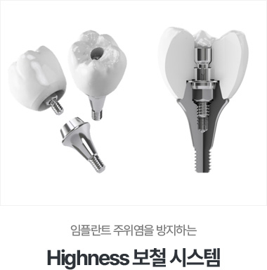 h3>Highness 보철 시스템