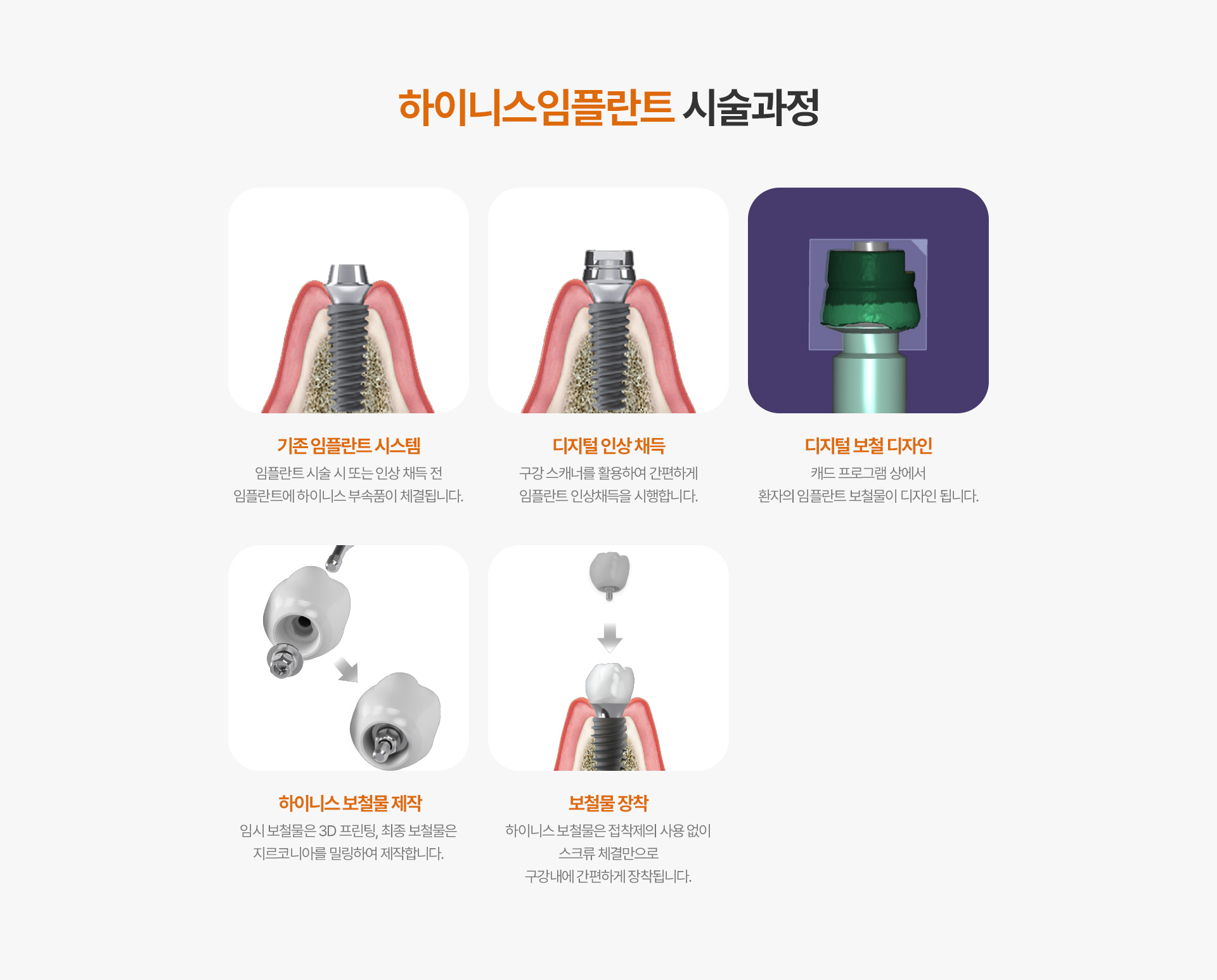 하이니스임플란트 시술과정