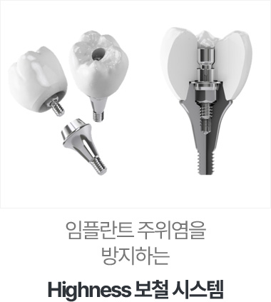 h3>Highness 보철 시스템