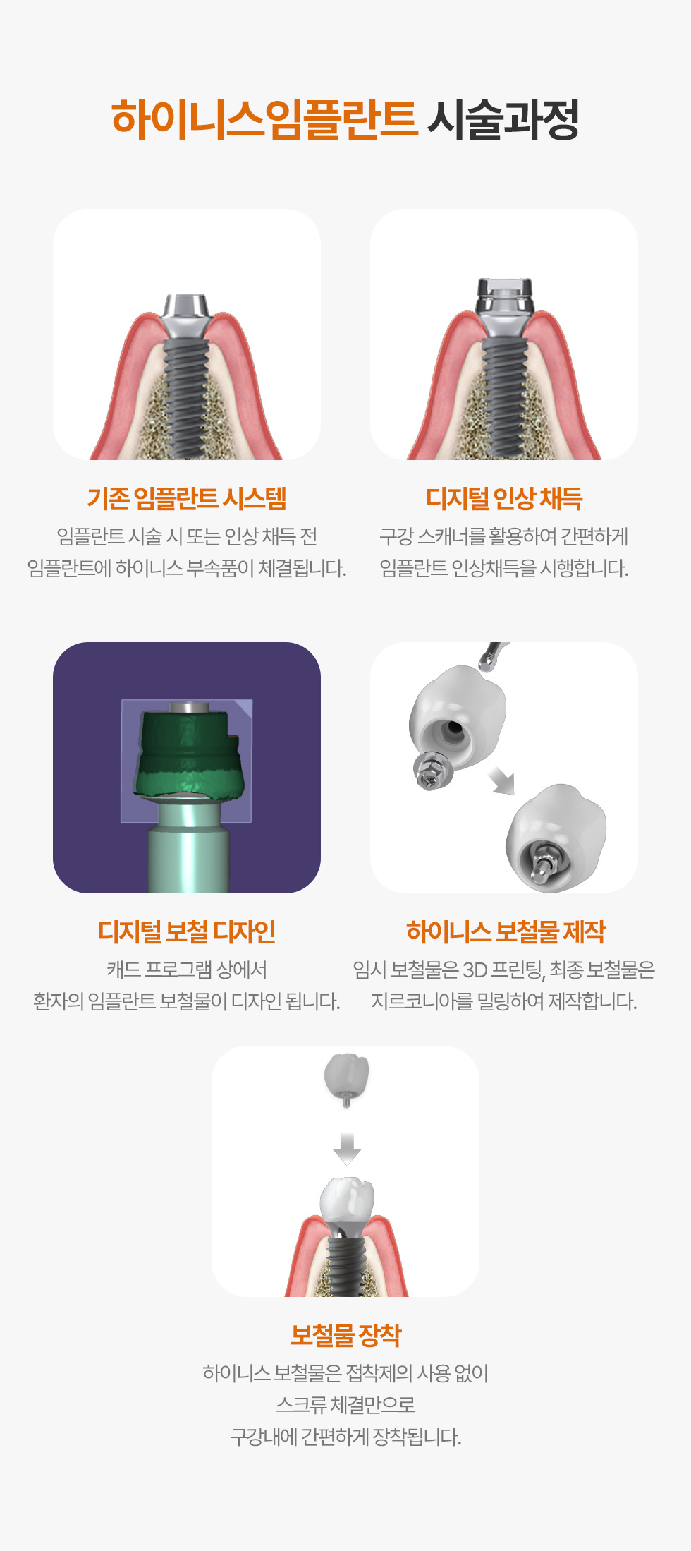 하이니스임플란트 시술과정