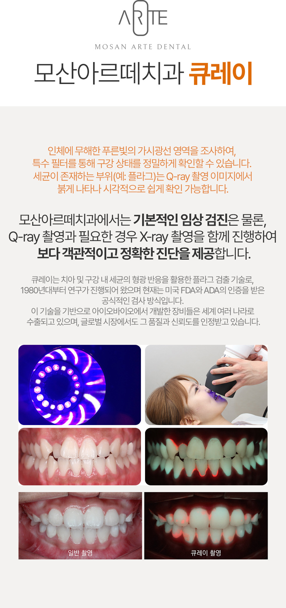 의식하진정요법