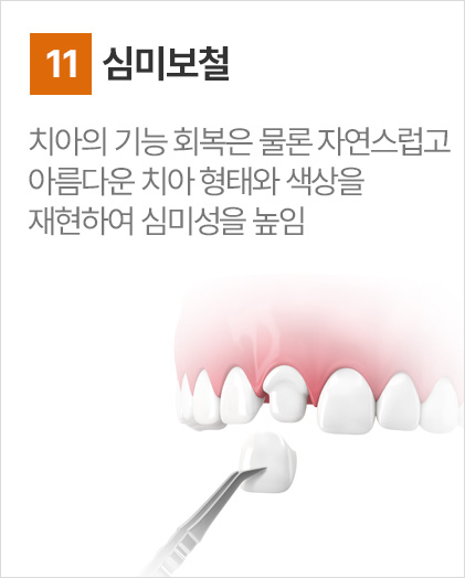 심미보철