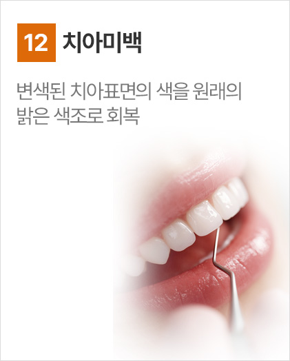 치아미백