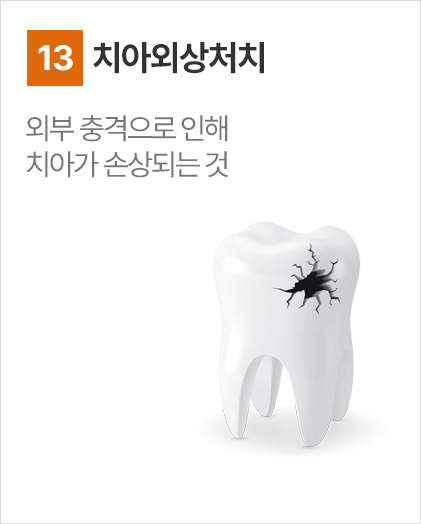 치아외상처치