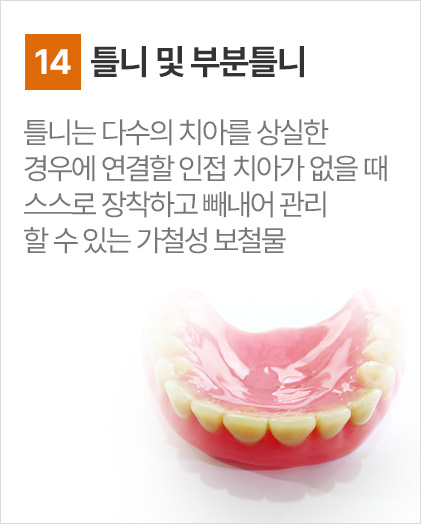 틀니 및 부분틀니