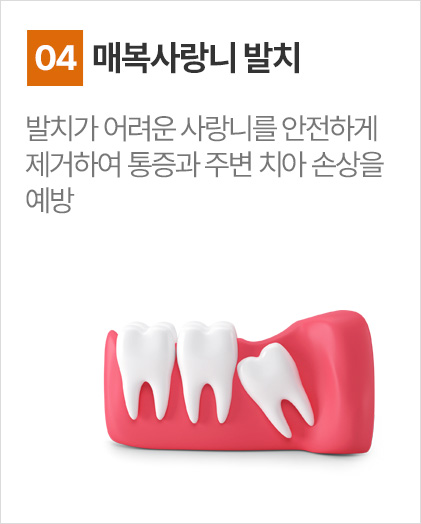 매복사랑니 발치