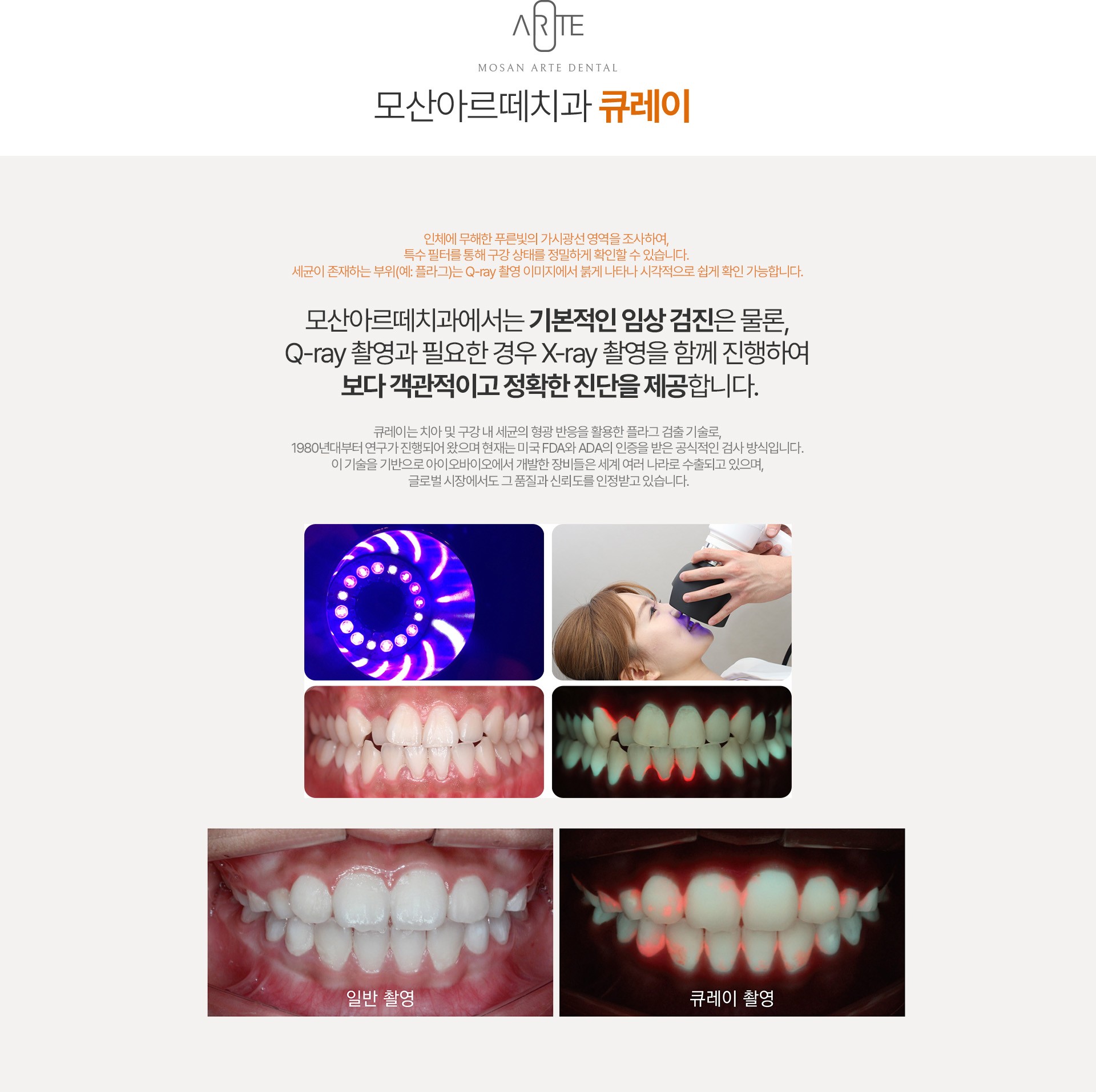 의식하진정요법