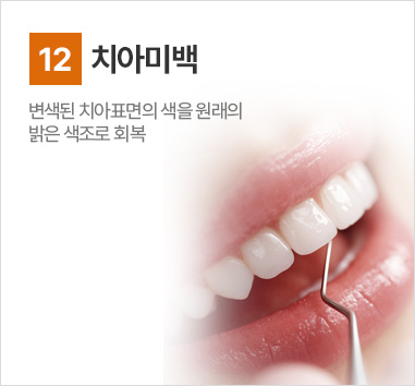 치아미백