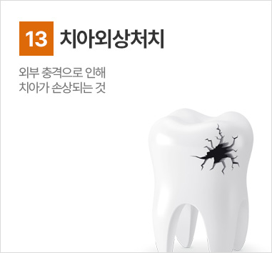 치아외상처치