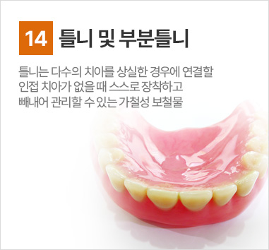 틀니 및 부분틀니