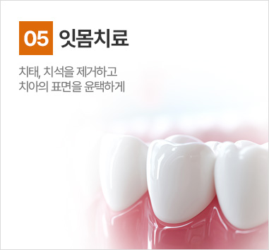 잇몸치료